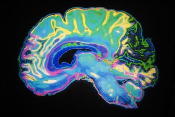 Bilde MRI brain colourbox